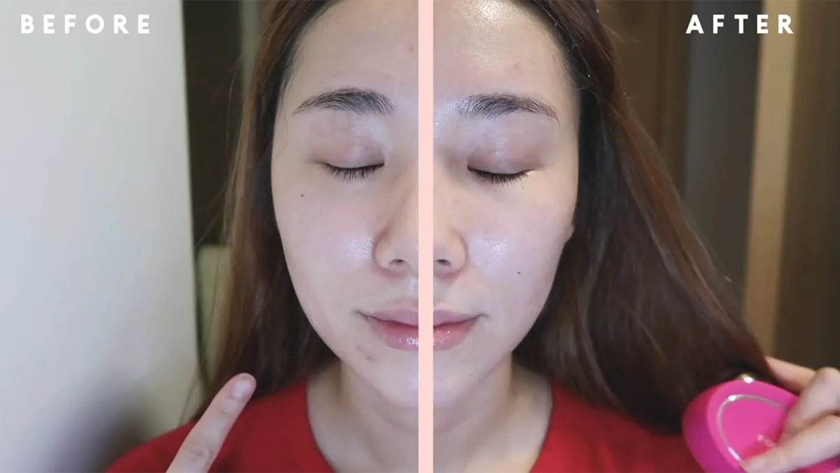 FOREO BEAR microcurrent facial before and after